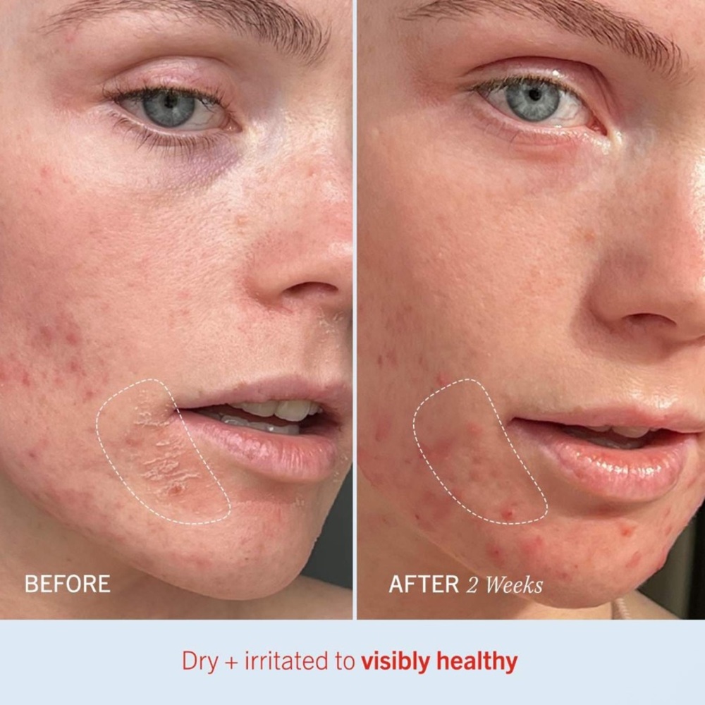 🌸 FIRST AID BEAUTY Ultra Repair Cream - Picture 3 of 5